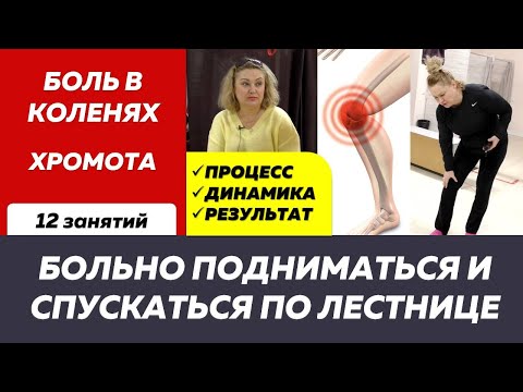 Боль в коленях и хромота: когда лечение идёт не по плану