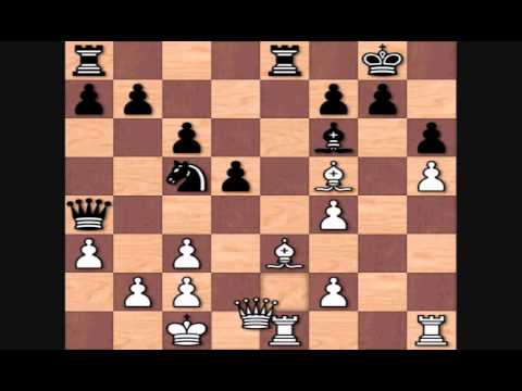 Hikaru Nakamura's Worst Games: vs Anish Giri