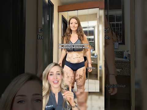 Doctor reacts: weight loss transformation