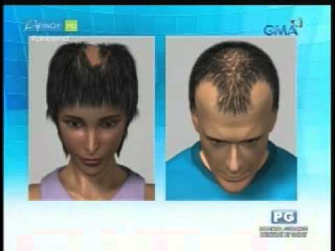 Malyshev paraan upang mangayayat Bran na may yogurt at cinnamon para sa pagbaba ng timbang