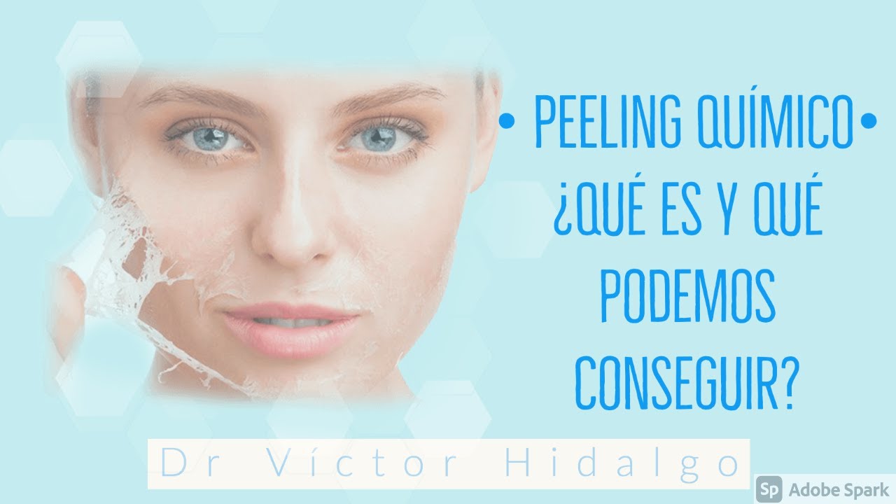 Víctor Hidalgo López-14