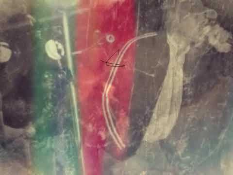 Pressure 28 - on these streets