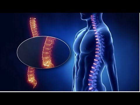 Aidacare Back Safety Video