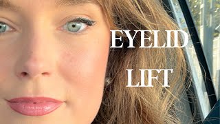 How to lift your eyelids and eyebrows naturally