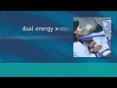 Bone Mass in Children and Adolescents