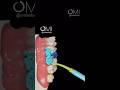 Dental Motivation Dental Implants Implantation Teeth Dental Dentistry Dentalimplant