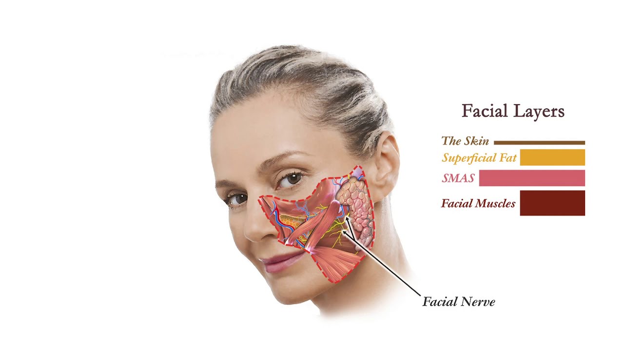 Facelift Anatomy | How Face Lifts work | Aesthetic Minutes #Facelift #Anatomy