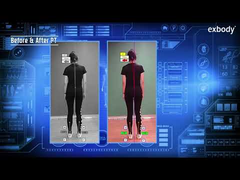 ExBody: The Ultimate Musculoskeletal Health Solution