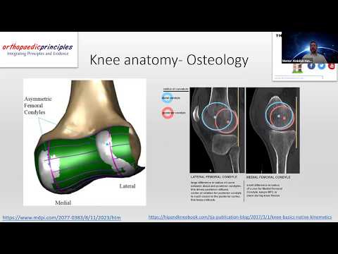 Biomechanics of Knee Replacement