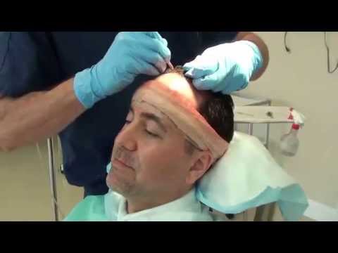 Jay's Surgery