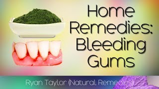 Home Remedies: for Bleeding Gums