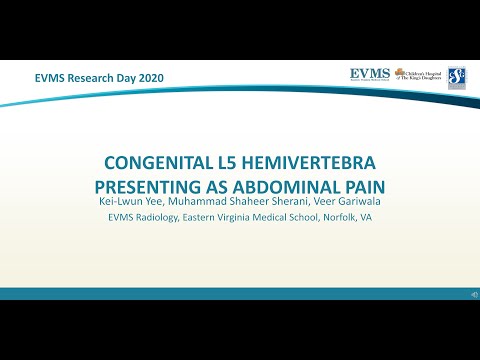 Thumbnail image of video presentation for Congenital L5 hemivertebra presenting as abdominal pain