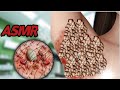 ASMR The Best Treatment Of Hidden Hair In The Armpits And Eliminat Cleaning Armpit Filmi ASMR