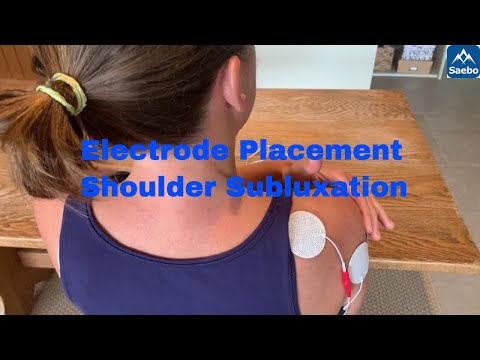 Electrode Placement : Shoulder Subluxation