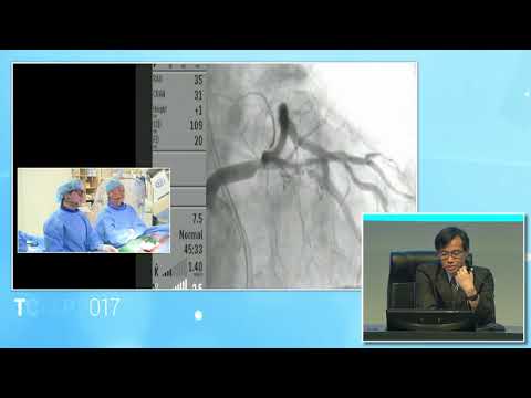 [TCTAP 2017] CTO Live - Live Case Session IV