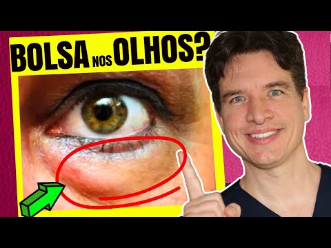 Doctor Explains How to Get Rid of EYE BAGS