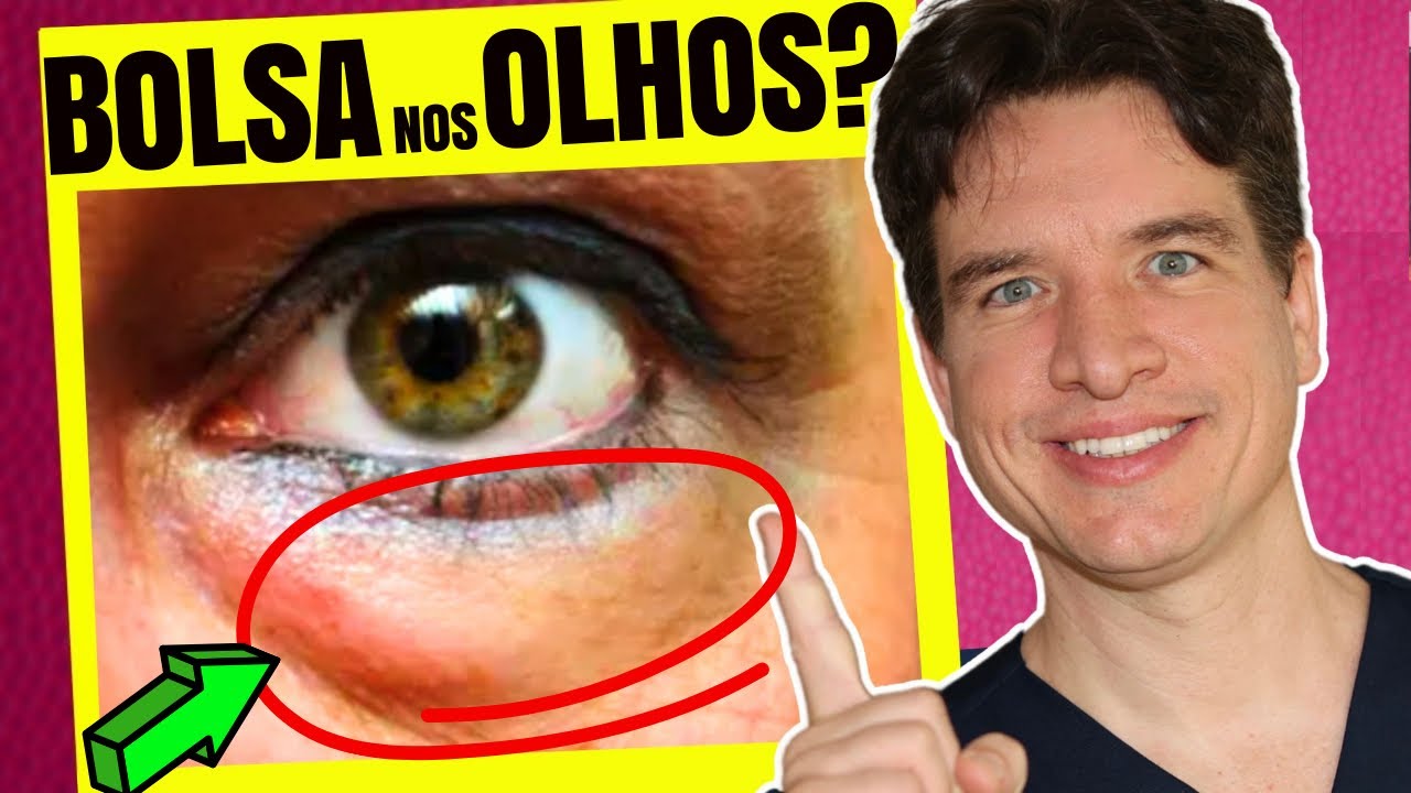 Doctor Explains How to Get Rid of EYE BAGS