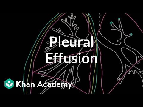 What is a pleural effusion? | Respiratory system diseases | NCLEX-RN | Khan Academy