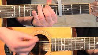 Play This Is the Life like Amy Macdonald