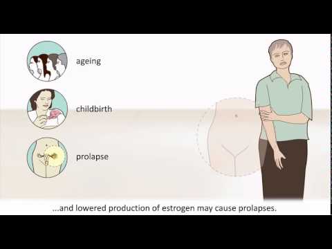 Menopause - What Is Menopause? Causes, Symptoms, What Happens