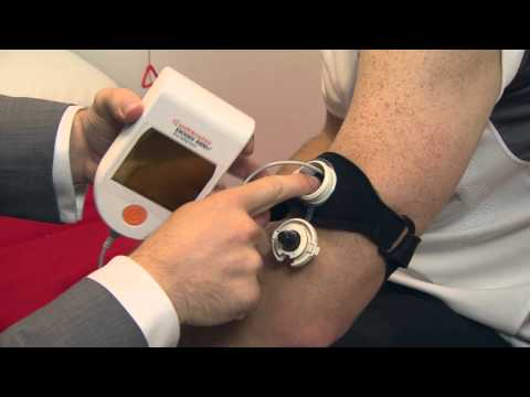 EXOGEN Fitting - Broken Arm (us)