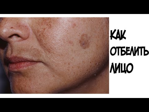 Какое масло для пигментации для лица Отбеливание лица в корее