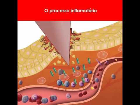 Processo Inflamatório