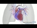 What Is Pulmonary Hypertension