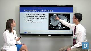 Causes of High Calcium | Masha Livhits, MD & Michael Yeh, MD | UCLAMDChat