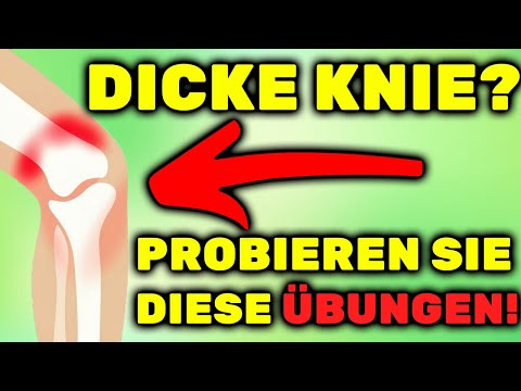THICK KNEES? These exercises will make the swelling disappear FAST!