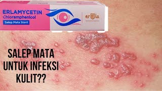 Download lagu Apakah salep mata antibiotik bisa digunakan untuk mengatasi infeksi kulit?? #salepkulit #salepmata mp3