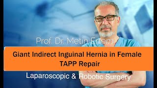 Miniaturka - Giant Indirect Inguinal Hernia in Female. TAPP Repair. Metin Ertem. MD.FACS