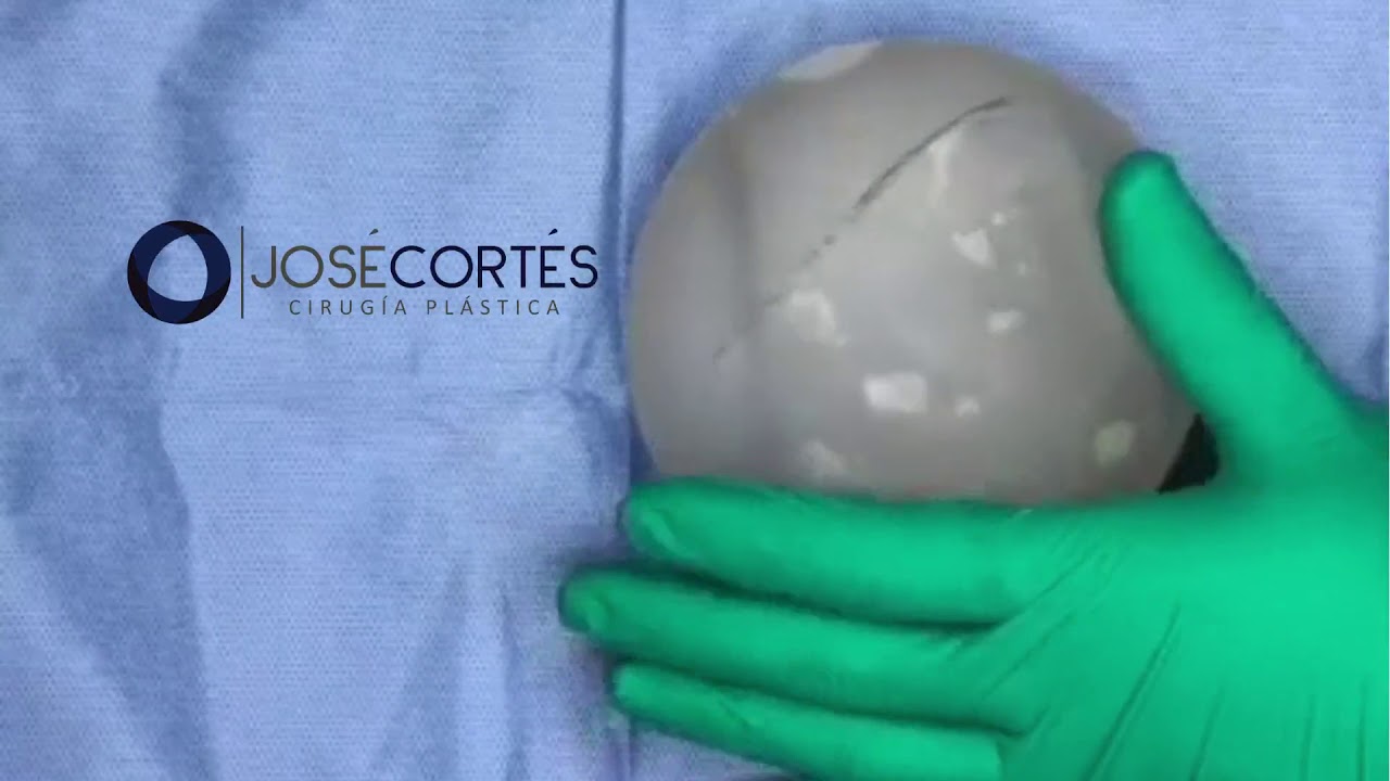 José Cortés Arreguin-47