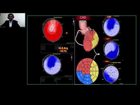 Vivid Talks - ECHO beyond EF – Diagnosis to Prognosis with Dr. R.Manivasagam