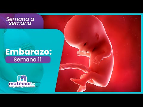 Semana 11 de embarazo: Esta es la ecografía de la semana 11 de gestación | Maternar.co