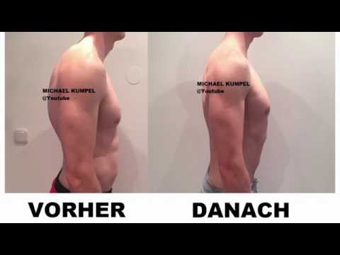 Volksmedizin zur Behandlung von Gelenken der Hände Zervikalen Osteochondrose Patch Voltaren Bewertungen