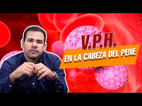 VPH en la cabeza del PENE