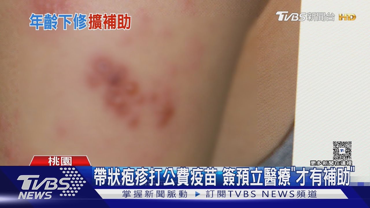 放寬年齡門檻至50歲!桃園皮蛇疫苗「這樣做」第二劑免費