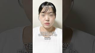 여행가서 인생샷 건지고 싶다면 에이빼하세요 ✨