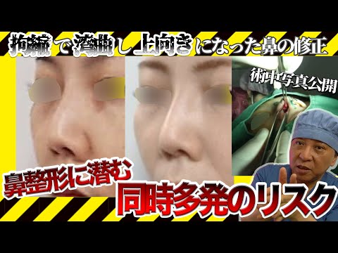 バンバムさんはシリコンプロテーゼの問題で病院に緊急搬送されました、理解してください