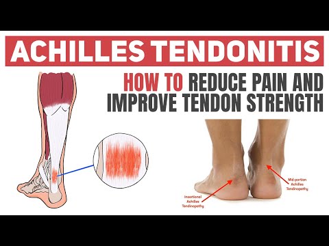Achilles Tendinitis - Exercises to Heal and Strengthen Your Tendon