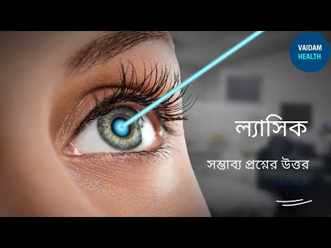 ল্যাসিক -প্রায়শই জিজ্ঞাসিত প্রশ্নাবলী