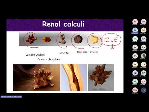 Practical Path Obstructive kidney diseases Dr. Alladin Gadri