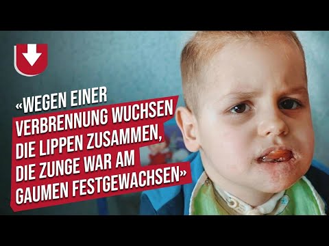 Mein Sohn hat Säure getrunken: Katjas Geschichte | Muttersein hautnah