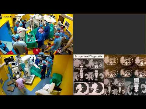 XIIIth INTERNATIONAL CONGRESS OF NEW DEBATE IN UROLOGY VIth NORTH AFRICAN CONGRESS OF UROLOGY