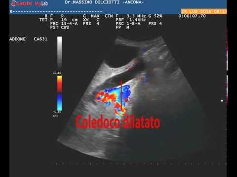 Da vermi per gattini prazitsid Siccome i vermi sono trasmessi per un bacio