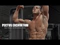 PECTUS EXCAVATUM - MOTIVATIONAL VIDEO - RILEY BYRNE - BODYBUILDING