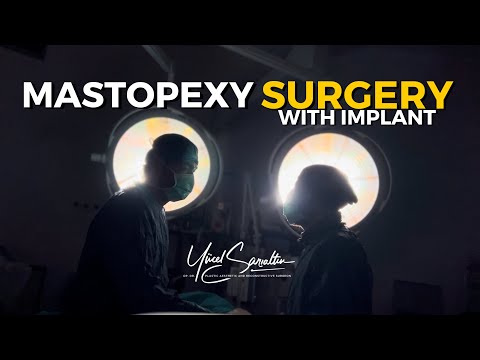 Mastopexy Surgery With Implant – Breast Lift Surgery