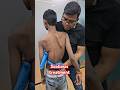 Scoliosis Treatment Drrajneeshkant WorldfamousChiropractor
