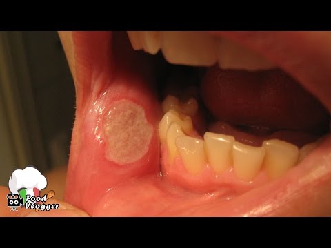 Quello che è migliore che una targa da vermi per la persona per prevenzione per bambini I parassiti sono gli organismi che nutrono sostanze organiche
